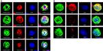 PDI Antibody in Immunocytochemistry (ICC/IF)