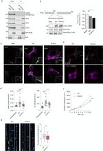 alpha Adaptin Antibody in Immunocytochemistry (ICC/IF)