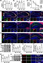 IBA1 Antibody in Immunohistochemistry (IHC)