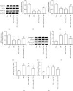 Alpha-Smooth Muscle Actin Antibody in Western Blot (WB)