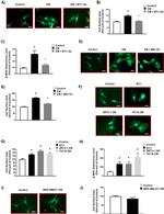 Endothelin 1 Antibody in Neutralization (Neu)