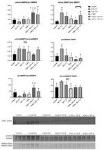 MMP9 Antibody in Western Blot (WB)