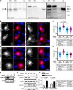 Phospho-GFAP (Ser8) Antibody in Western Blot (WB)