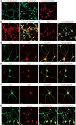 VGLUT1 Antibody in Immunocytochemistry (ICC/IF)