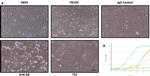 beta Amyloid Antibody in Neutralization (Neu)