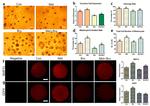 BMP-15 Antibody in Immunocytochemistry (ICC/IF)