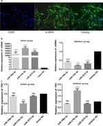 Alpha-Smooth Muscle Actin Antibody in Immunocytochemistry (ICC/IF)