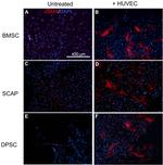 Alpha-Smooth Muscle Actin Antibody in Immunocytochemistry (ICC/IF)