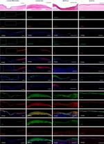 Cytokeratin 1 Antibody in Immunocytochemistry (ICC/IF)