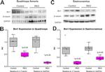 beta Tubulin Antibody in Western Blot (WB)