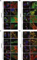 DYKDDDDK Tag Antibody in Immunocytochemistry (ICC/IF)