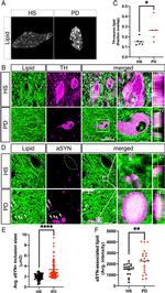 alpha Synuclein Antibody in Immunocytochemistry, Immunohistochemistry (Paraffin) (ICC/IF, IHC (P))