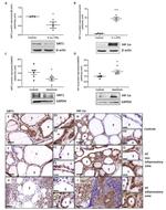 SIRT1 Antibody in Immunohistochemistry (IHC)