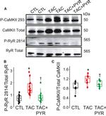 Phospho-CaMKII beta/gamma/delta (Thr287) Antibody in Western Blot (WB)