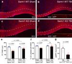 beta Amyloid Antibody in Immunohistochemistry (IHC)