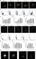 Thrombospondin 1 Antibody in Immunohistochemistry (IHC)