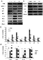 SREBP1 Antibody in Western Blot (WB)