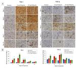 TIM-1 Antibody in Immunohistochemistry, Immunohistochemistry (Paraffin) (IHC, IHC (P))