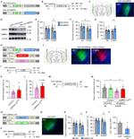 CaMKII beta Antibody in Western Blot (WB)