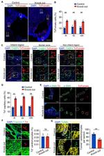 Cardiac Troponin T Antibody in Immunohistochemistry (IHC)