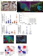 CD20 Antibody in Immunohistochemistry (IHC)