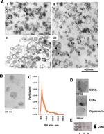 Glypican 1 Antibody in Immunohistochemistry (IHC)