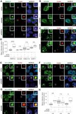 SART1 Antibody in Immunocytochemistry (ICC/IF)