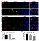 IL-8 (CXCL8) Antibody in Immunocytochemistry (ICC/IF)