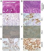 PD-L1 Antibody in Immunohistochemistry (IHC)