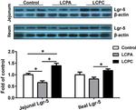 LGR5 Antibody in Western Blot (WB)