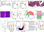 Cardiac Troponin T Antibody in Immunohistochemistry (IHC)