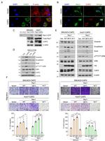 RAC1 Antibody in Western Blot (WB)