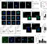 LAMP-2A Antibody in Immunocytochemistry (ICC/IF)