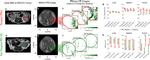 Folate Receptor alpha Antibody in Immunohistochemistry (IHC)