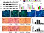 Eotaxin 3 Antibody in Neutralization (Neu)