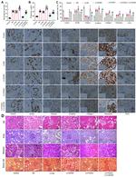 TCF7L2 Antibody in Immunohistochemistry (IHC)