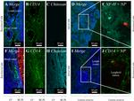 NF-H Antibody in Immunocytochemistry (ICC/IF)