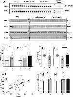 mGluR1 Antibody in Western Blot (WB)