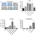 FOXP3 Antibody in Immunohistochemistry (IHC)