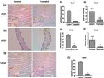 VEGF Antibody in Immunohistochemistry (IHC)