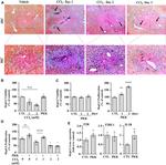 Plasma Kallikrein Antibody in Immunohistochemistry (IHC)