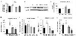 Myostatin Antibody in Western Blot (WB)