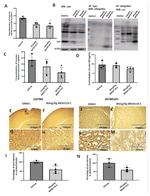 alpha Synuclein Antibody in Western Blot, Immunohistochemistry, Immunoprecipitation (WB, IHC, IP)