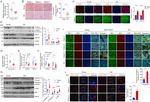 Bi-1 Antibody in Immunohistochemistry (IHC)