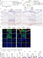 Cytokeratin 14 Antibody in Immunohistochemistry (IHC)