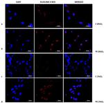 p53 Antibody in Immunocytochemistry (ICC/IF)