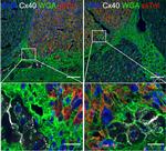 Cardiac Troponin T Antibody in Immunohistochemistry (IHC)