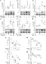 Phospho-FGR (Tyr412) Antibody in Western Blot (WB)