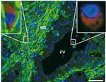 Progesterone Receptor Antibody in Immunohistochemistry (IHC)