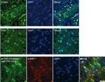 Progesterone Receptor Antibody in Immunocytochemistry (ICC/IF)